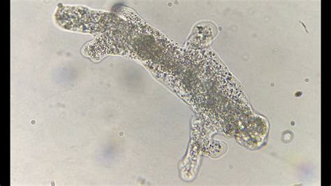  Goodeid Amoeba: This Microscopic Mastermind Uses Pseudopodia for Locomotion and Feeding!