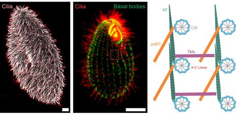  Lagenophrys: Eine Reise in die Welt der beweglichen Ciliaten und ihrer faszinierenden Nahrungsaufnahme!